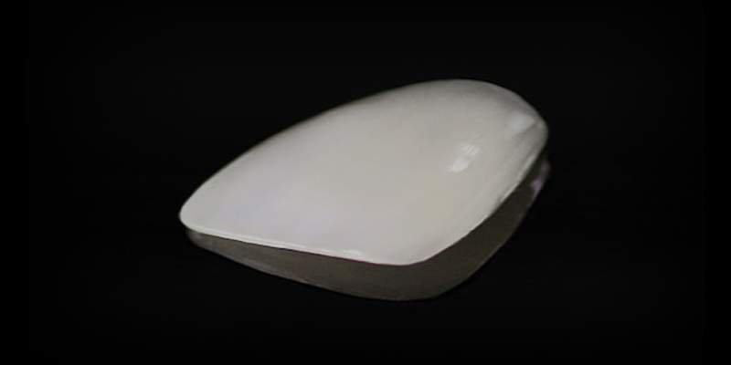 FACCETTE-DENTALI1 FACCETTE-DENTALI1