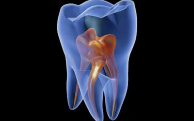 Endodonzia