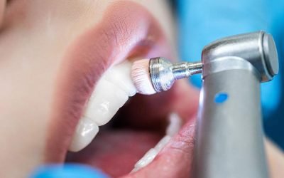 Igiene orale e prevenzione