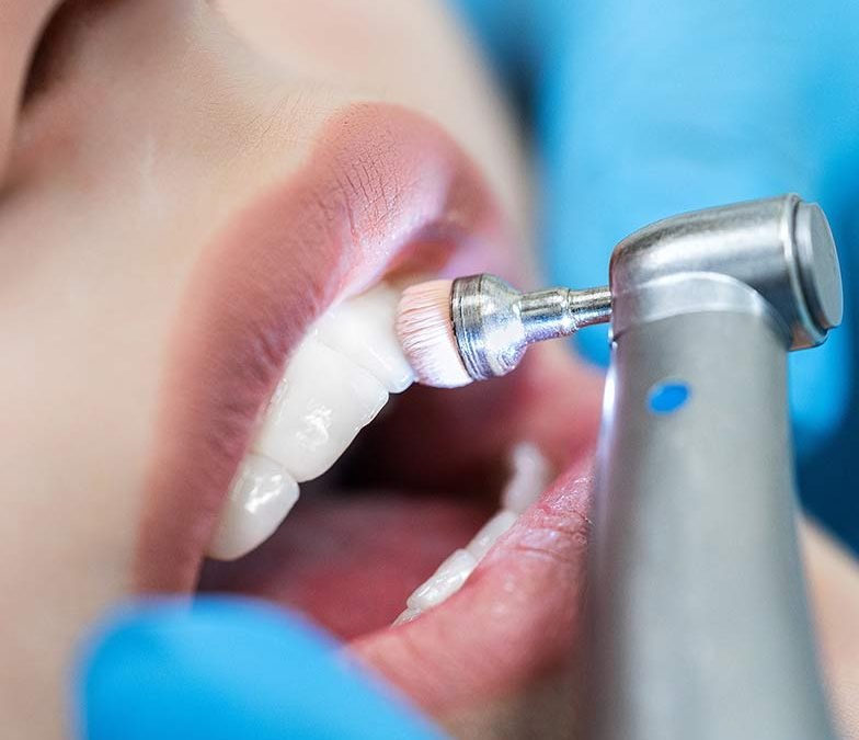 Igiene orale e prevenzione